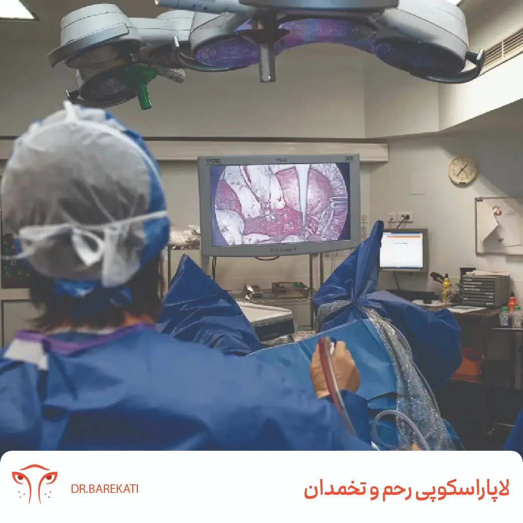 لاپاراسکوپی رحم و تخمدان