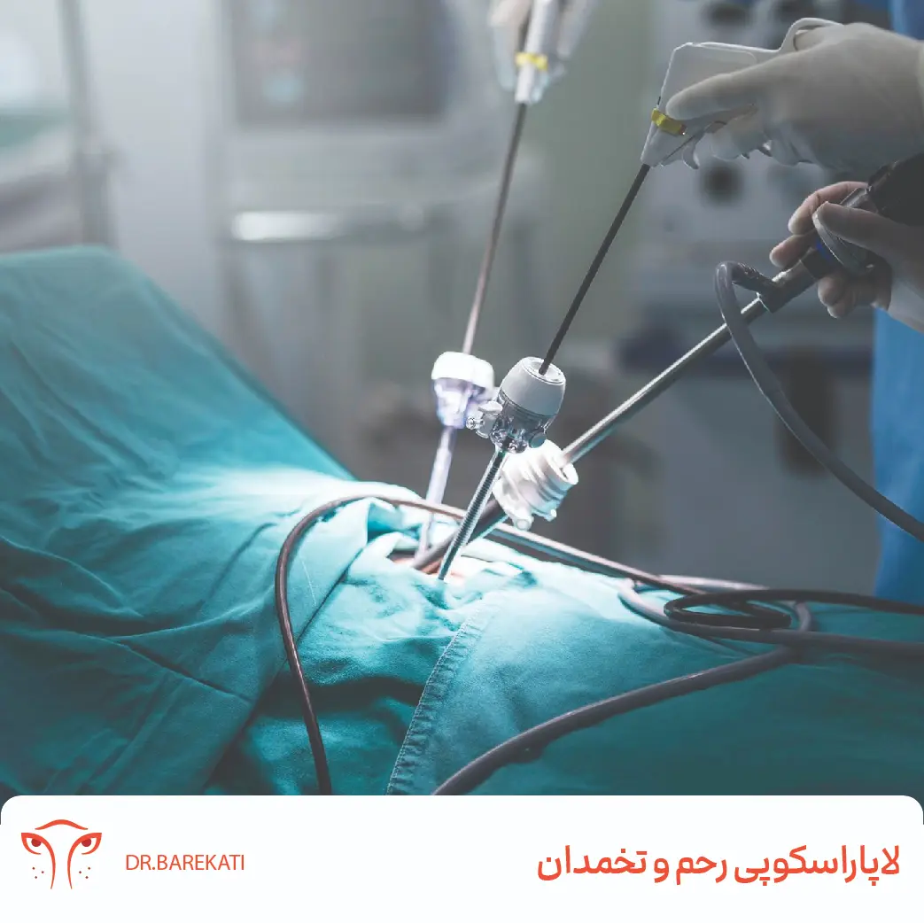 عمل جراحی لاپاراسکوپی رحم و تخمدان