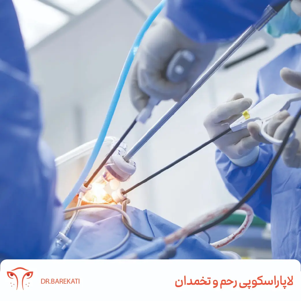 عمل لاپاراسکوپی رحم و تخمدان