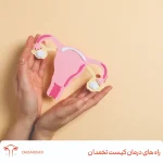 درمان کیست تخمدان