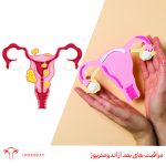 مراقبت های بعد از آندومتریوز